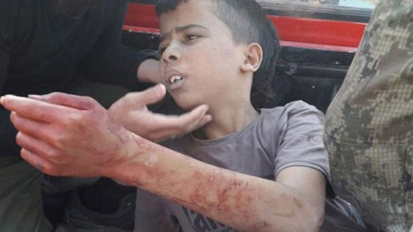 المعارضة &rsquo;المعتدلة&rsquo; المدعومة اميركيا تذبح طفلاً فلسطينياً بالسكين على خطى &rsquo;داعش&rsquo;