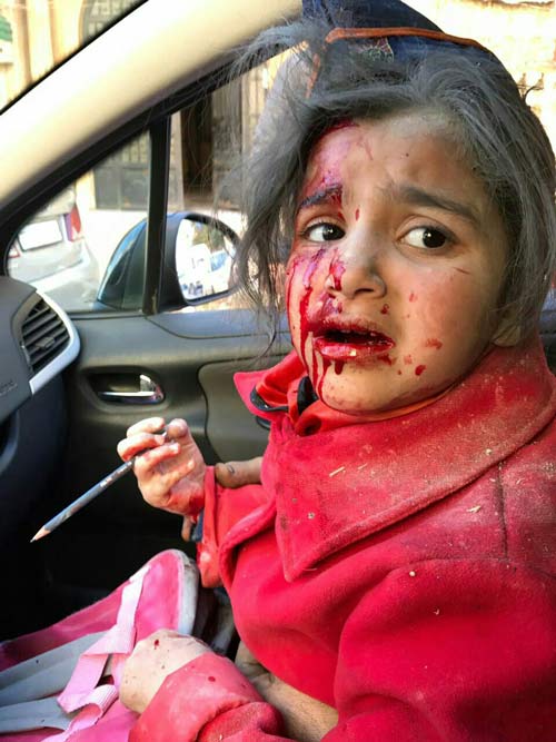 استشهاد 8 تلاميذ وإصابة 27 آخرين بينهم معلمة بقصف المسلحين لمدرسة الفرقان في حلب