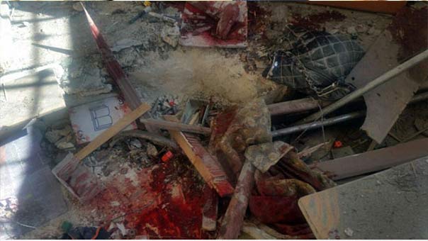 استشهاد 8 تلاميذ وإصابة 27 آخرين بينهم معلمة بقصف المسلحين لمدرسة الفرقان في حلب