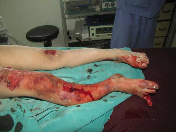 بالصور: فظاعة جرائم المسلحين بحق الاطفال في الفوعة وكفريا