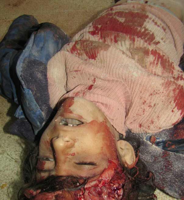 بالصور: فظاعة جرائم المسلحين بحق الاطفال في الفوعة وكفريا