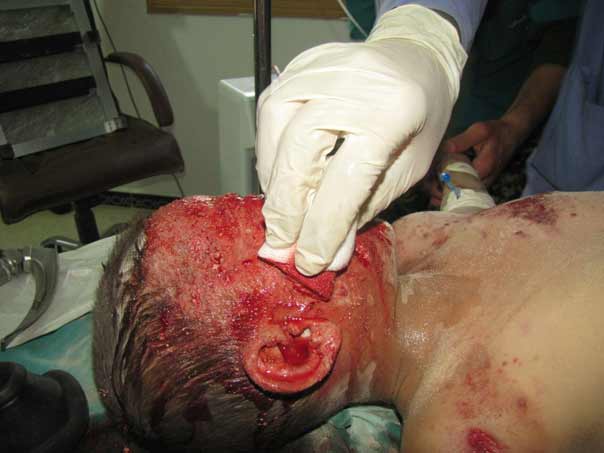 بالصور: فظاعة جرائم المسلحين بحق الاطفال في الفوعة وكفريا