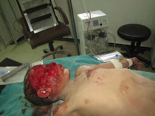 بالصور: فظاعة جرائم المسلحين بحق الاطفال في الفوعة وكفريا