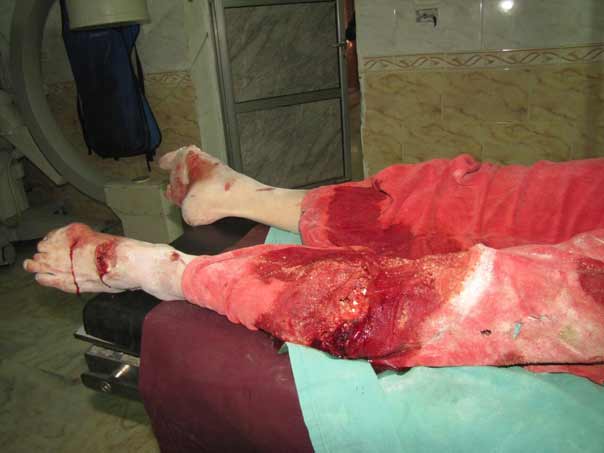 بالصور: فظاعة جرائم المسلحين بحق الاطفال في الفوعة وكفريا