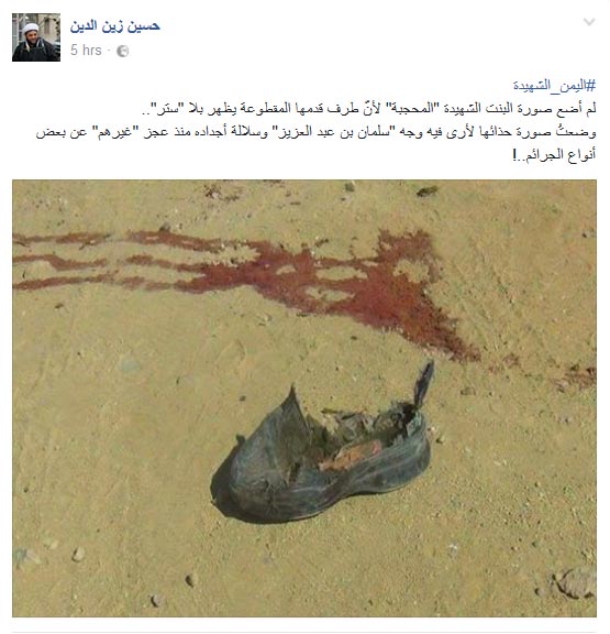 شهيدة العلم.. شاهدة على جرائم آل سعود وصمت العالم