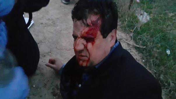 استشهاد فلسطيني في مواجهات عنيفة بالنقب .. و &rsquo;لجنة المتابعة&rsquo; تحمل الاحتلال مسؤولية التصعيد

 