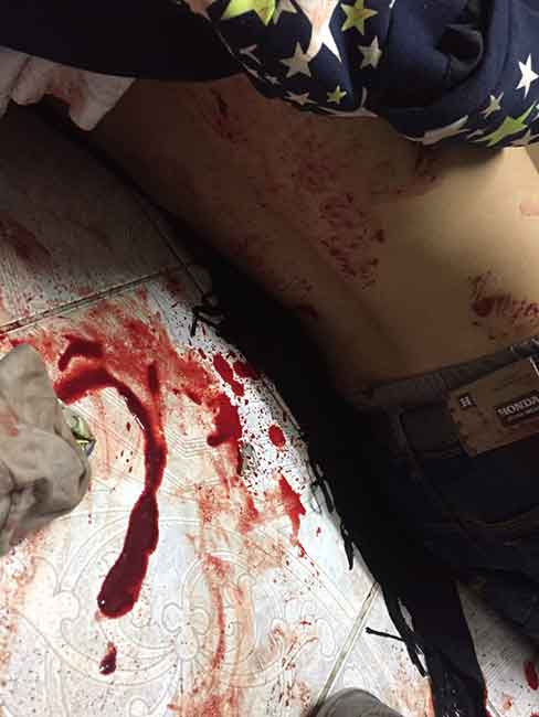 مشاهد الدراز توثّق جرائم النظام: هجوم دموي يصدّه الفدائيون