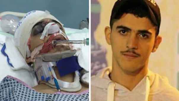 النظام البحريني يتنصّل من هجومه الدموي على معتصمي الدراز