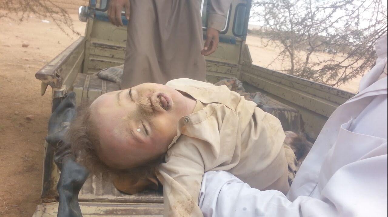 مجزرة مروعة يرتكبها العدوان السعودي في اليمن تسفر عن سقوط شهداء وجرحى