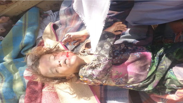 مجزرة مروعة يرتكبها العدوان السعودي في اليمن تسفر عن سقوط شهداء وجرحى