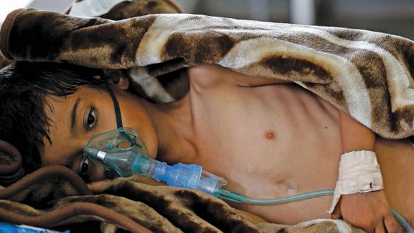 الكوليرا&rsquo; يفتك بالناجين من أطفال اليمن... فأين المنظمات الإنسانية؟