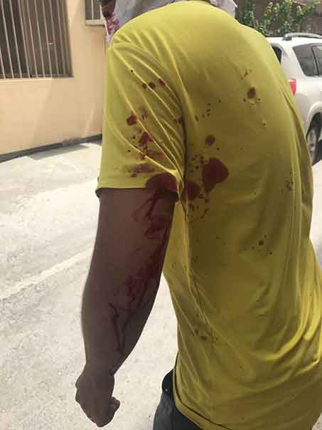 ارتقاء شهيد دفاعًا عن آية الله قاسم بعد مهاجمة قوات النظام البحريني  ساحة الفداء في الدراز