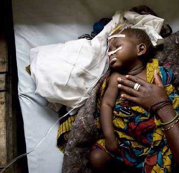 الكوليرا تقتل 500 شخص في الكونغو الديموقراطية