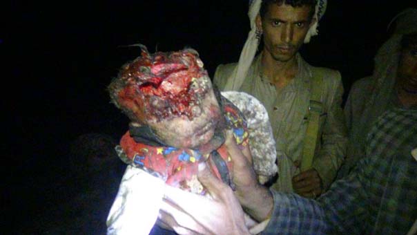 بالصور والأسماء: مجزرة سعودية مروعة بحق مسافرين في مأرب.. 12 شهيداً جلهم من الأطفال والنساء