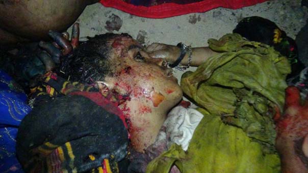 بالصور والأسماء: مجزرة سعودية مروعة بحق مسافرين في مأرب.. 12 شهيداً جلهم من الأطفال والنساء