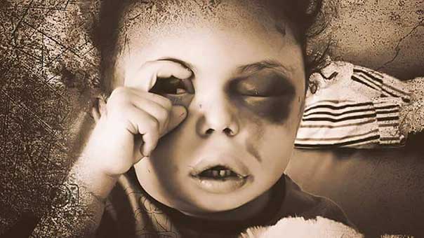 الطفلة اليمنية بثينة تقع ضحية كمين سعودي.. هكذا استغلّت مظلوميتها!