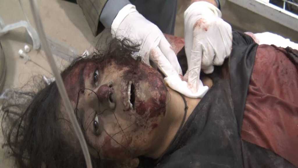 بالصور: طيران العدوان السعودي يرتكب مجزرة بحق الطفولة في صعدة