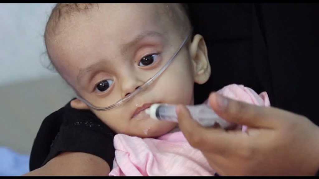 الأوضاع الإنسانية الكارثية في اليمن 