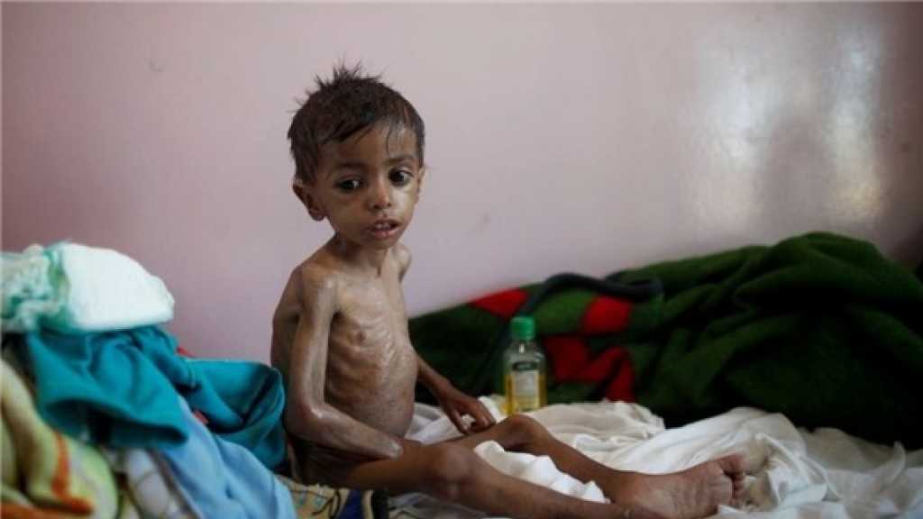  الامم المتحدة: أكثر من 22 مليون يمني بحاجة الى مساعدات