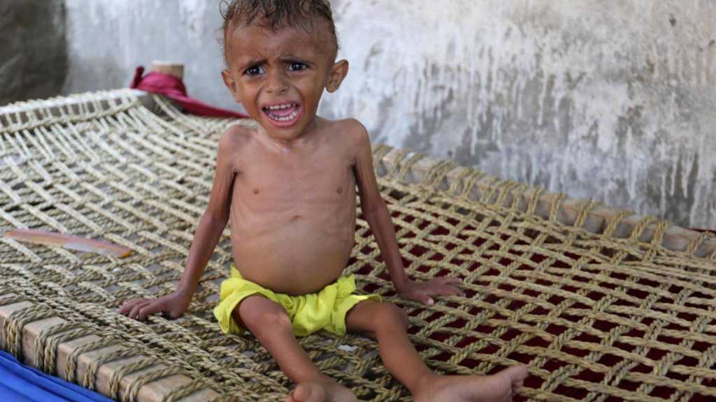 نيويوركر’: السعودية والإمارت تستخدمان سلاح ’التجويع’ في الحرب على اليمن