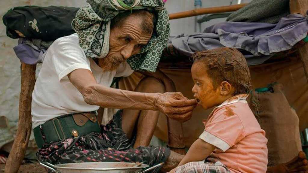 85 ألف طفل يمني قضوا بسبب سوء التغذية الحادّ