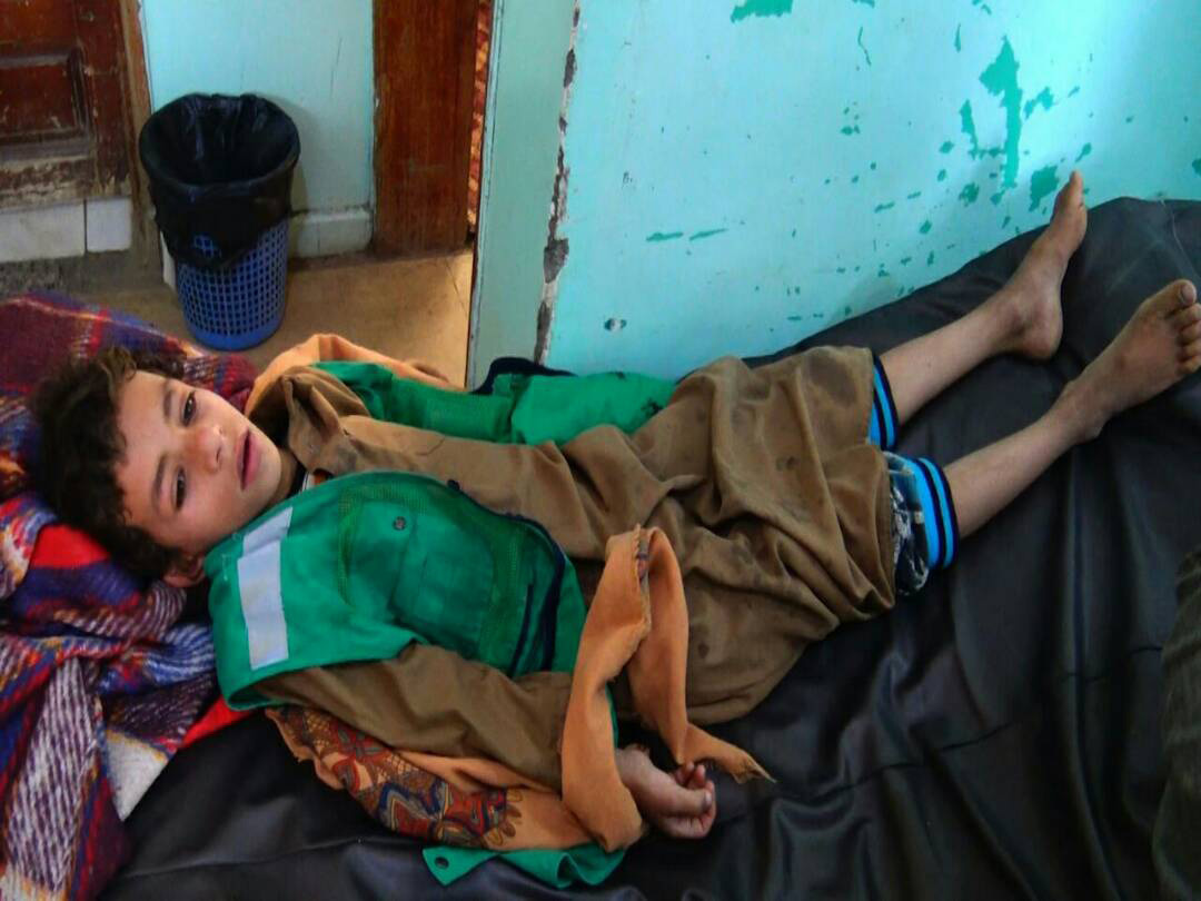 اليمن: صور ضحايا الغارات على مدخل مدينة صعدة شمال البلاد