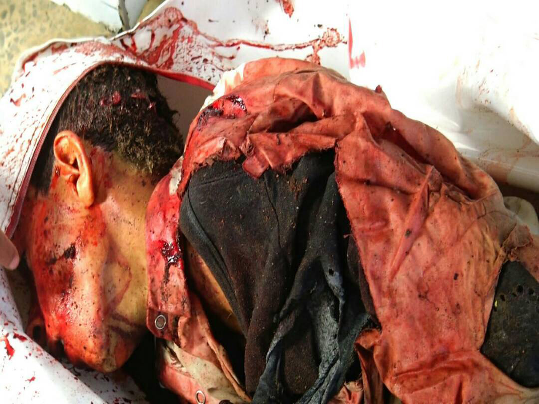 اليمن: صور ضحايا الغارات على مدخل مدينة صعدة شمال البلاد