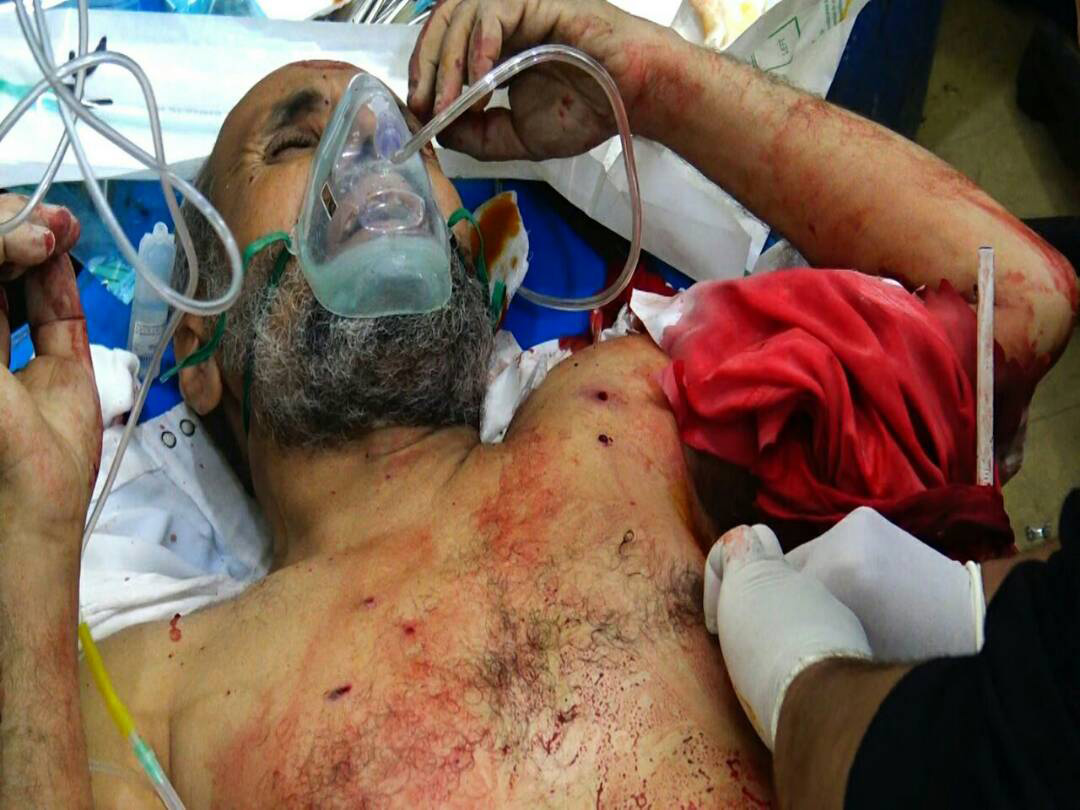 اليمن: صور ضحايا الغارات على مدخل مدينة صعدة شمال البلاد