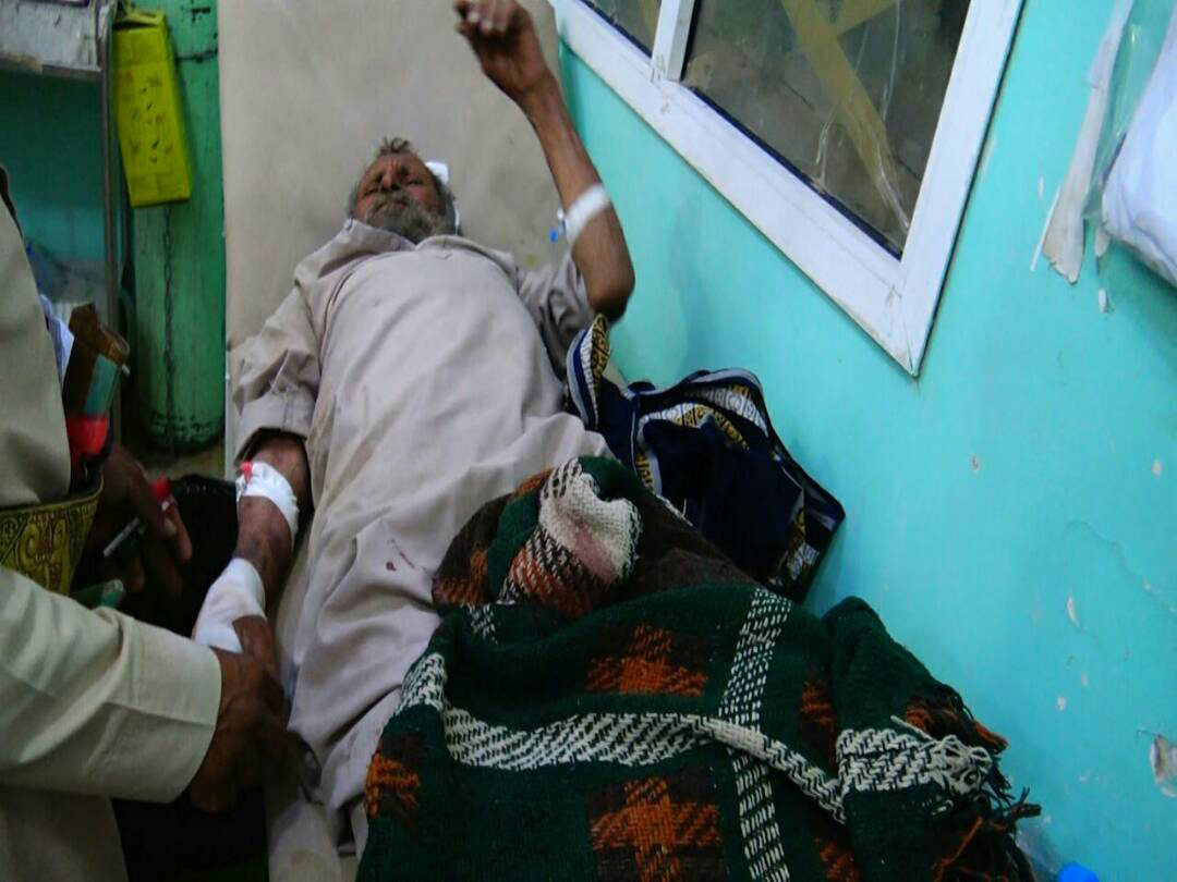 اليمن: صور ضحايا الغارات على مدخل مدينة صعدة شمال البلاد