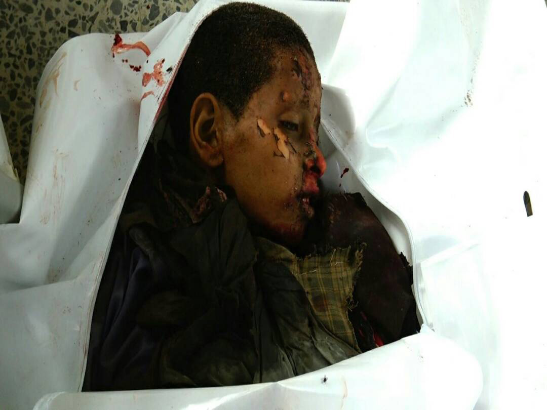 اليمن: صور ضحايا الغارات على مدخل مدينة صعدة شمال البلاد