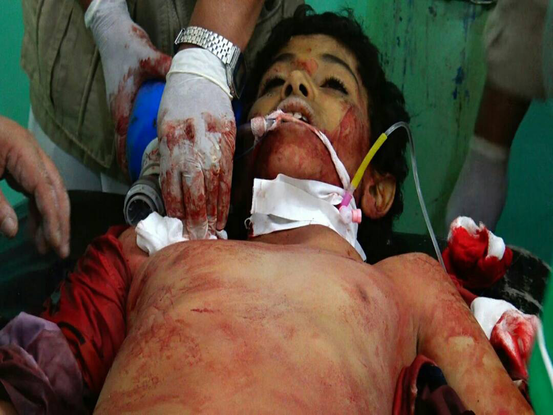 اليمن: صور ضحايا الغارات على مدخل مدينة صعدة شمال البلاد