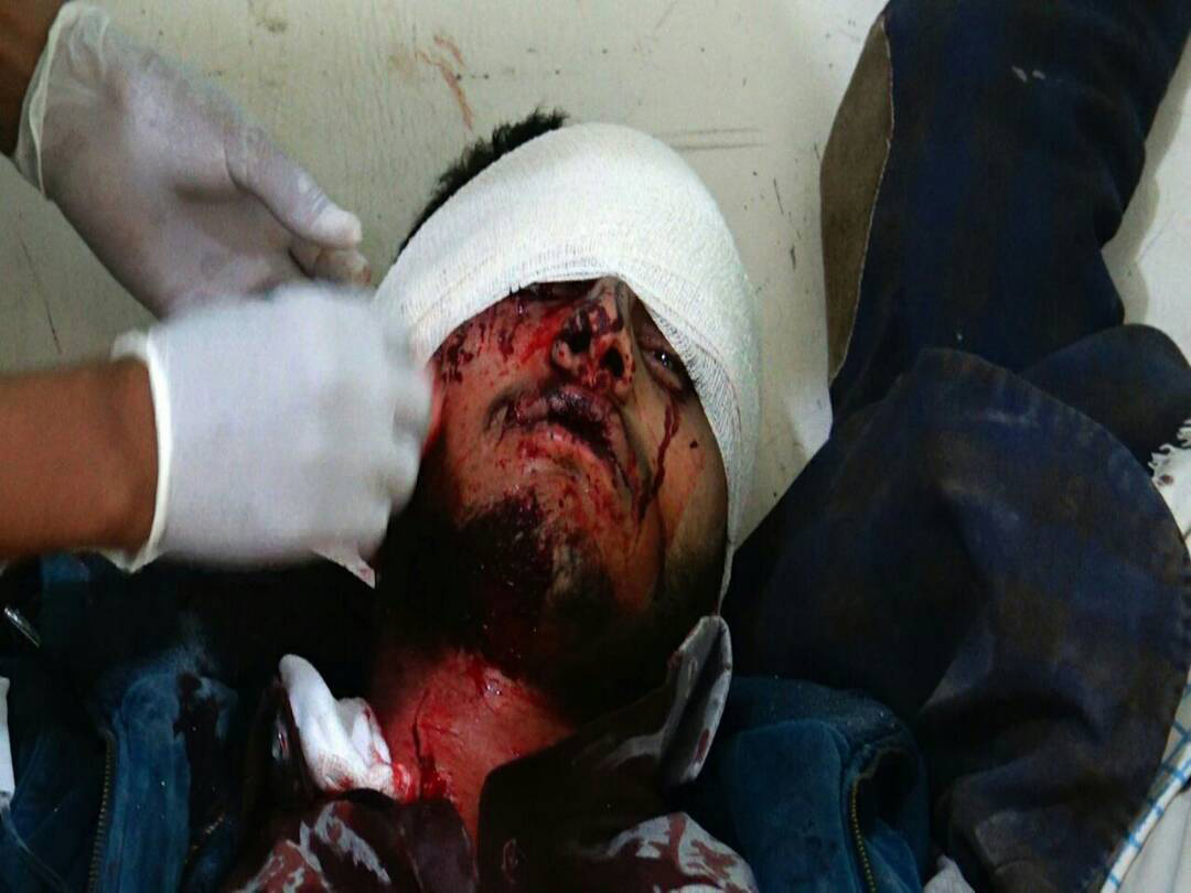 اليمن: صور ضحايا الغارات على مدخل مدينة صعدة شمال البلاد